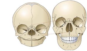 skull comparison 